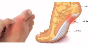 11 عارضاً في قدميكم يخبركم عن ضغط الدم والغدة الدرقية والتهاب المفاصل وأمراض أخرى