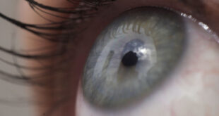 ثلاثة أعراض تصيب العين تكشف عن الإصابة بسرطان الرئة