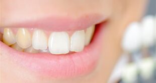 ابتسامتك صفراء؟.. 6 وصفات منزلية لاستعادة بياض الأسنان