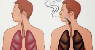 طرق طبيعية لتنظيف الرئتين عند المدخنين