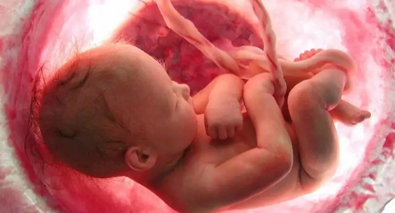 ولادة طفلة وبداخل بطنها جنين.. حالة نادرة أذهلت الأطباء