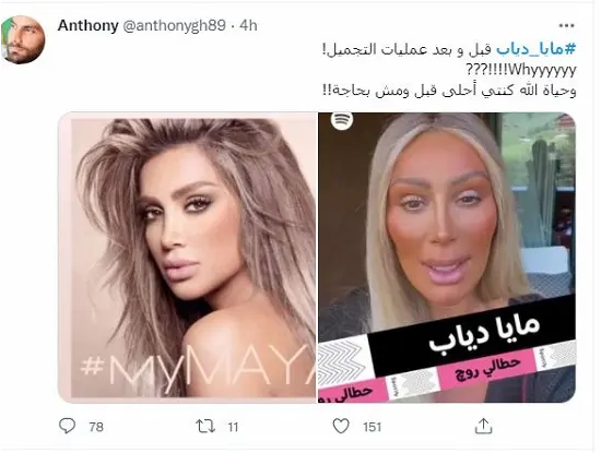 مايا دياب تصدم الجمهور بسبب شكلها المختلف