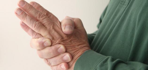 6 مشكلات صحية يشير إليها تنميل اليدين
