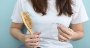 مكمّل يثبت فعاليته في تعزيز نمو الشعر لدى المصابين بالصلع النمطي
