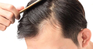 نصائح صحية لدرء مشكلة الشعر المتساقط