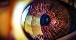علامة غريبة في العين قد تكون مؤشرا لسرطان خطير