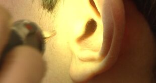جهاز إنذار بجسمك.. مشاكلك الصحية قد تبدأ من أذنيك!