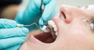طبيب أسنان يكشف زيف أساطير شائعة عن الأسنان