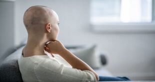 العلماء الروس يبتكرون تكنولوجيا تعالج السرطان دون التسبب بتساقط الشعر